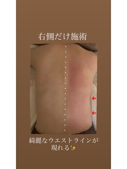 ウララカ(uraraka)/