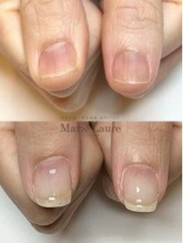 マリーロール 梅田店(Marie Laure)/自爪育成/深爪矯正/ネイルケア