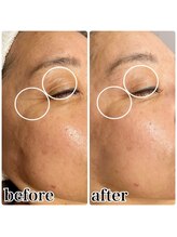 楚々(SOSO)/1回目！