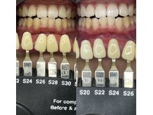 トウキョウスワーズ 池袋店(TOKYO SWRS)/#ホワイトニング #池袋 #渋谷