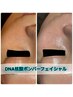 【人気No.2】毛穴洗浄＋肌育DNAミネラル酵素ケア