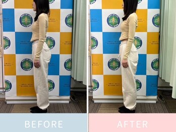 ベスト整骨院/首元が劇的ビフォーアフター！