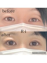 アールアイ(R-i)/アイリッドアップパーマ