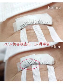 ウル(ulu)/NOBIRU美容液