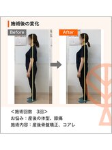 ただき接骨院 整体院 石原院/お悩み：産後の体型、膝痛