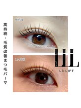 エフ(eFu)/◇L3リフト◇