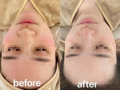 リベレスタ(liberesta)の写真