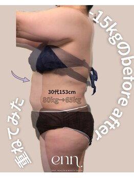 エン(enn.)/30代 驚きの-15kg!!!!