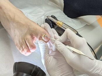 オーキッド巻き爪サロンの写真/手元も見られてます!爪のプロによる本格ハンドケア★ガサガサ乾燥・ささくれを撃退し、潤う美爪へ♪