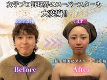 ミーアキャット 福岡天神(MEERKAT)の雰囲気（一度の施術で得れる4つの効果に加え1ヶ月に渡り増幅していく効果）