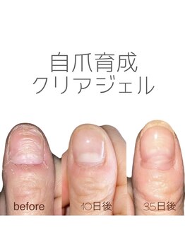 スペル オン ネイルズ(Spell on nails)の写真/深爪などでお悩みの方★自爪育成クリアジェル