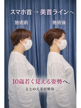 ととのえ美容整体の写真/慢性肩こりや腰痛、姿勢の崩れにお悩みの方。本格的な整体でしっかり身体のケアをしてみたい方。