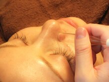 パルファム/毛穴の黒ずみ吸引