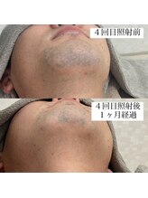 テンパ ビューティー(+10%beauty)/効果写真