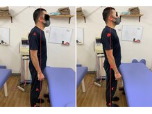 ワイズ 宜野湾鍼灸整骨院/猫背改善