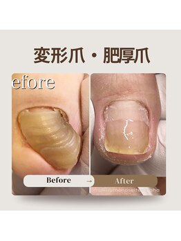 巻き爪補正店 那覇店/