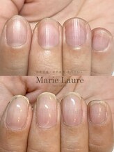 マリーロール 天王寺店(Marie Laure)/深爪矯正/自爪育成/ネイルケア/