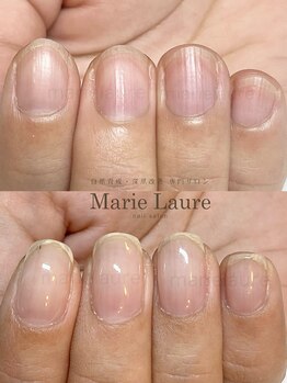 マリーロール 天王寺店(Marie Laure)/深爪矯正/自爪育成/ネイルケア/