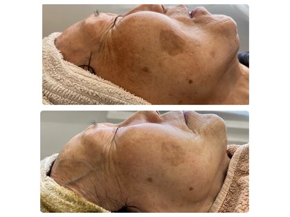 リンネ(Rin'ne)の写真