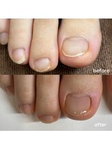 リリ(lili)/フットネイルスキンケア1回目