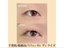 ヴィライズ 船橋(VIRISE)の雰囲気（【一重瞼・奥二重さん】お任せ下さい☆/東船橋駅/船橋駅/津田沼）