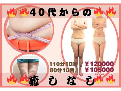 フレクシーの写真