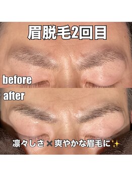 リエル(RIEL)/【眉脱毛】