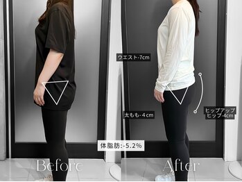 リフ(RIF)/体脂肪減少で見た目スッキリ♪