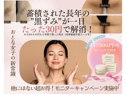 モア(more.)の写真