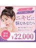 【電話予約のみ当日予約不可】ニキビあらゆるお肌のお悩みオーナー施術