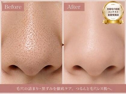 アデュラリアン(Adularian)の写真