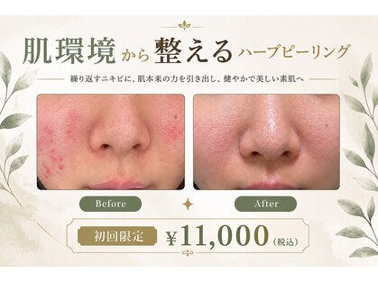 ウララ(ulala)の写真
