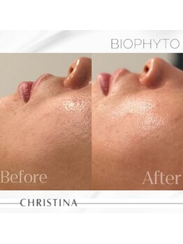 サロン ド ブラン アオヤマ(Salon de BLANC AOYAMA)/CHRISTINAビオフィート