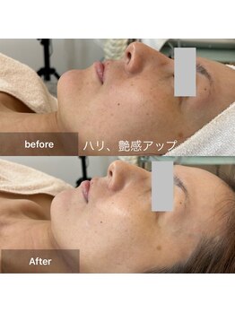 ルミエール(Lumiere)/ハリ艶感UP!