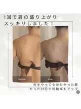 ナイスデイ(Niceday!)/肩こり解消