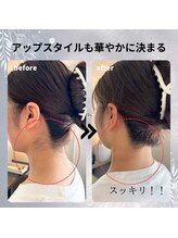 ヒダマリ 新屋敷店(Hidamari)/脱毛デビューにうなじオススメ