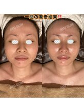 アユスリム(AYU SLIM)/一回でも変化できるの充実小顔