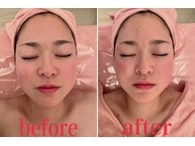 小顔矯正 アメリ ビューティーサロン(Ameri beauty salon)/韓国式コルギ小顔コース