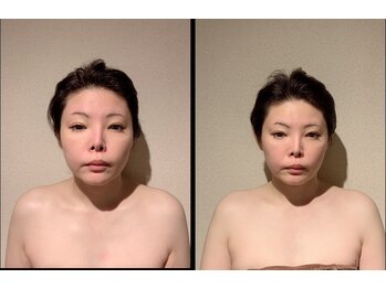 りっつ鍼灸院/頭からお顔まで小さく変化！