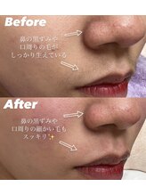 エリス(ELISSE)/本日の素肌美人