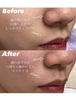 エリス(ELISSE)/本日の素肌美人