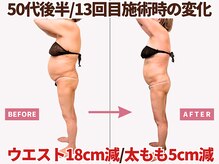 べモーレ 上本町 谷町九丁目(Bemolle)の雰囲気（インディバや脂肪冷却やハイパーナイフ超えの圧倒的効果で痩身☆）