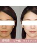 くすみリセット×隠れ鎖骨フェイスライン格上げコース【高濃度水素】