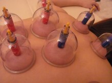 メアリーズ ボーテ 目黒店/【オプション】背中のカッピング