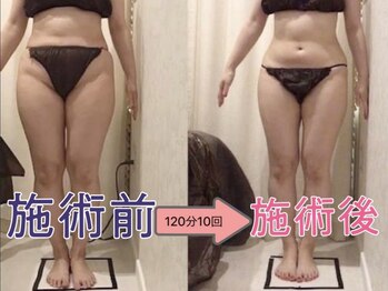 上野エステサロン レア(Lea)/ランキング【御徒町/上野】