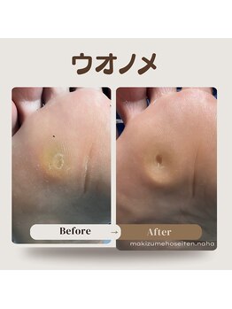 巻き爪補正店 那覇店/