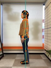 シード(SEED)/30代女性　after