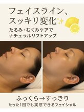 ブリリアントスマイル/レモンボトルで二重顎　スッキリ