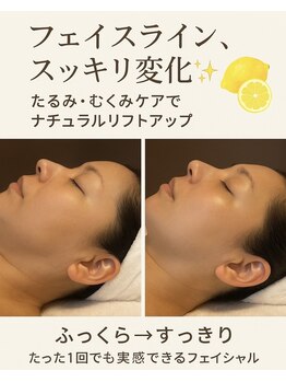 ブリリアントスマイル/レモンボトルで二重顎　スッキリ