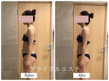 リノ(Lino)/ブライダルエステ♪巻き肩改善